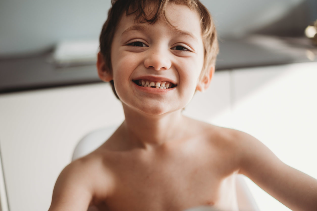 A closeup of Miles grin, featuring the gap where his missing tooth once was